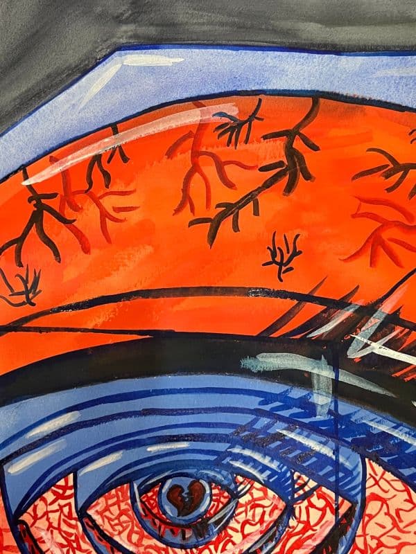 憂鬱症患者的眼睛2號(Sad,too sad No.2) 5