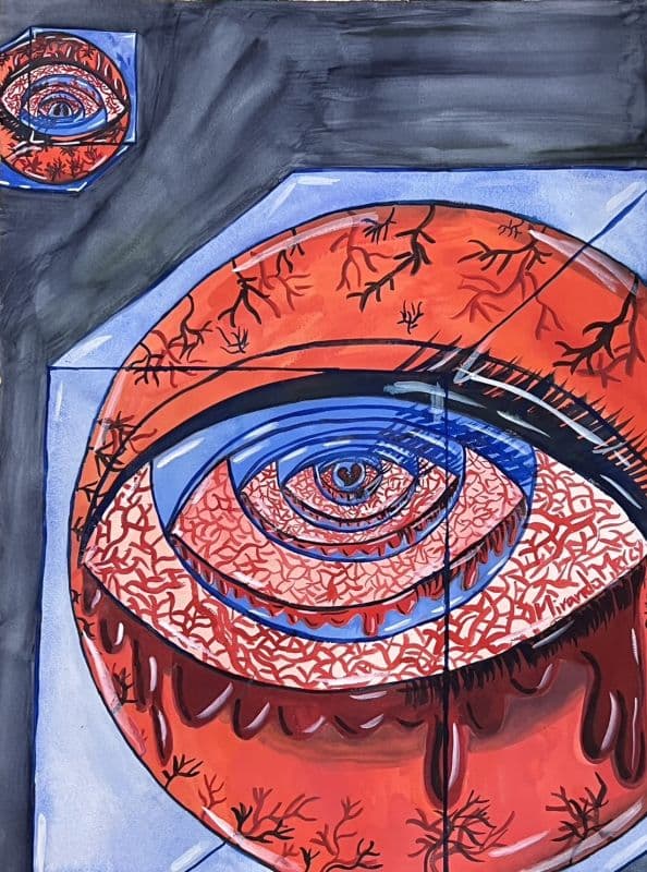 憂鬱症患者的眼睛2號(Sad,too sad No.2) 1